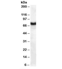 Frizzled 8 Antibody / Wnt Signaling Receptor Antibody Human Pancreas WB. Western blot analysis of human pancreas lysate using Frizzled 8 Antibody / Wnt Signaling Receptor Antibody at 1 ug/ml. A distinct immunoreactive band is detected at approximately 73 kDa, consistent with the predicted molecular weight of Frizzled 8, supporting specific detection of this Wnt signaling receptor in human pancreatic tissue.