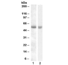 Western blot testing of human 1) pancreas and 2) kidney lysate with TMPRSS2 antibody at 0.1ug/ml. Predicted molecular weight: ~54 kDa.