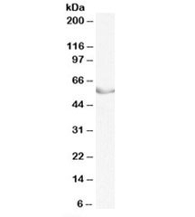 LRH1 Antibody Pig Ovary WB. Western blot testing of pig ovary lysate with LRH1 antibody at 0.3ug/ml. Predicted molecular weight (pig): ~56kDa.