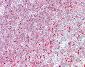 IHC testing of FFPE human spleen tissue with TPD52 antibody at 3.75ug/ml. Required HIER: steamed antigen retrieval with pH6 citrate buffer; AP-staining.