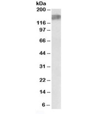 ALK Antibody Rat Brain WB. Western blot analysis of rat brain lysate using ALK antibody at 0.03 ug/ml identifies a prominent band near 170-180 kDa, consistent with the predicted molecular weight of Anaplastic lymphoma kinase / ALK. Detection of ALK in rat neural tissue supports the established association of this receptor tyrosine kinase with nervous system development and neuronal signaling-associated pathways.