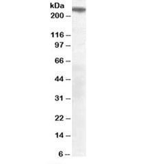 SORLA Antibody Mouse Brain WB. Western blot analysis of SORLA expression was performed using anti-SORLA antibody in mouse brain lysate. SORLA (SORL1) is a VPS10-domain endosomal sorting receptor that regulates intracellular protein trafficking, receptor recycling, and lysosomal targeting. In neurons, SORLA plays a critical role in amyloid precursor protein (APP) trafficking and maintenance of protein homeostasis, making it an important marker in Alzheimer's disease research. A specific immunoreactive band is detected at approximately 250 kDa, consistent with the predicted molecular weight of SORLA. These results support the utility of SORLA Antibody for studies of endosomal sorting, intracellular trafficking, neurobiology, and neurodegenerative disease.