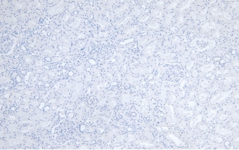 Negative control: IHC staining of FFPE human kidney tissue without primary antibody. HIER: steamed with pH6 citrate buffer, HRP-staining.