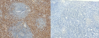 AIF-1 Antibody Spleen Immunohistochemistry. IHC staining of FFPE human spleen tissue with AIF-1 antibody (left) and without AIF-1 antibody (right, negative control). Required HIER: steamed antigen retrieval with pH6 citrate buffer.