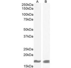 AIF-1 Antibody Mouse and Rat Brain WB. Western blot testing of A) mouse brain and B) rat brain lysate with AIF-1 antibody at 1ug/ml. Predicted molecular weight: ~17 kDa.