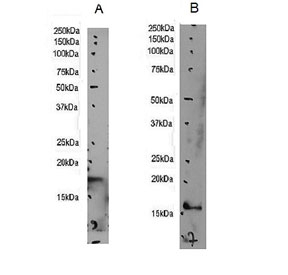 AIF-1 Antibody Rodent Brain WB. Western blot testing of A) mouse brain and B) rat brain lysate with AIF-1 antibody. Predicted molecular weight: ~17 kDa.