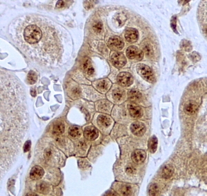 Jagged 1 Antibody Kidney IHC. Immunohistochemistry staining of FFPE human kidney tissue using Jagged 1 Antibody / Notch Signaling Ligand Antibody demonstrates distinct cytoplasmic and membranous HRP-DAB brown staining within renal tubular epithelial cells. The staining pattern is consistent with expression of JAG1, a transmembrane Notch ligand that mediates cell-cell communication and regulates cellular differentiation, tissue maintenance, and developmental signaling pathways. Jagged 1 plays important roles in kidney development, epithelial homeostasis, and Notch pathway activation within renal tissues. HIER was performed by steaming tissue sections in pH 6 citrate buffer prior to immunostaining. The antibody was applied at 2 ug/ml and staining was visualized using an HRP detection system.