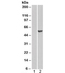 IRF6 Antibody HEK293 Overexpression WB. Western blot analysis of IRF6 expression was performed using anti-IRF6 antibody in HEK293 cells transiently overexpressing IRF6. Lane 1: mock-transfected HEK293 lysate. Lane 2: IRF6-overexpressing HEK293 lysate. IRF6, also known as Interferon Regulatory Factor 6, is a DNA-binding transcription factor that regulates epithelial differentiation, tissue morphogenesis, and developmental signaling. A prominent immunoreactive band is detected at approximately 53 kDa in the IRF6-transfected sample, corresponding to the predicted molecular weight of IRF6 isoform 1 (~53 kDa). Minimal signal is observed in the mock-transfected control, supporting the specificity of IRF6 detection. These results support the utility of IRF6 Antibody for studies of developmental biology, epithelial differentiation, and transcriptional regulation.