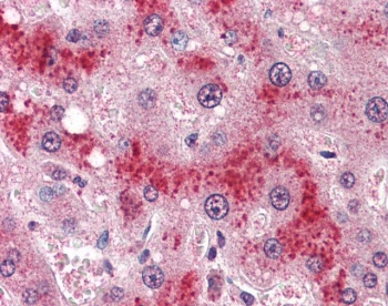 IHC testing of FFPE human liver tissue with Leptin Receptor antibody at 4ug/ml. Required HIER: steamed antigen retrieval with pH6 citrate buffer; AP-staining.