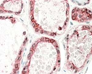 IHC staining of FFPE human thyroid gland with thyroid Peroxidase antibody at 5ug/ml. HIER: steamed with pH6 citrate buffer, AP-staining.