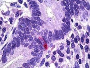 IHC testing of FFPE human intestine with Pancreatic Polypeptide antibody at 5ug/ml. HIER: steamed antigen retrieval with pH6 citrate buffer; AP-staining.