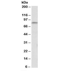 CD97 Antibody Thymus WB. Western blot testing of mouse thymus tissue lysate using goat polyclonal CD97 antibody at 0.3 ug/ml. Immunoreactive bands are detected corresponding to expected CD97 receptor species, including processed forms associated with autoproteolytic cleavage of Adhesion G protein-coupled receptor E5 / ADGRE5. The observed expression pattern is consistent with the known leukocyte-associated and immune tissue distribution of this adhesion GPCR.