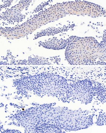 IHC testing of FFPE human esophagus tissue in the presence (top) and absence (bottom) of PAX3 antibody at 4.5ug/ml. Required HIER: steamed antigen retrieval with pH6 citrate buffer; HRP-staining.