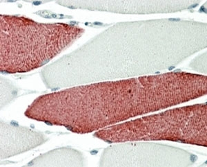 IHC staining of FFPE human skeletal muscle with TNNT3 antibody at 5ug/ml. HIER: steamed with pH6 citrate buffer, AP-staining.