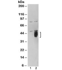 Western blot of HEK293 lysate overexpressing TFPI and probed with TFPI antibody (mock transfection in lane 1). Predicted/observed molecular weight: 35/40-50kDa.