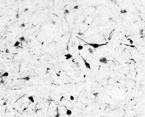 IHC testing of frozen human hypothalamic paraventricular nuclei with Tyrosine Hydroxylase antibody at 0.1ug/ml. A biotin secondary followed by SAv-HRP and DAB were used for the staining. Image courtesy of Prof. Erik Hrabovszky, Institute of Experimental Medicine, Budapest, Hungary.