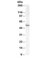 Western blot testing of mouse testis lysate with ARSA antibody at 0.5ug/ml. Expected molecular weight: 53-63 kDa.
