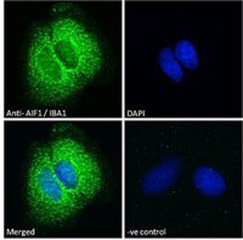 IBA1 Antibody IF. Immunofluorescent staining of FFPE human Caco-2 cells with IBA1 antibody (green) at 10ug/ml and DAPI nuclear stain (blue).