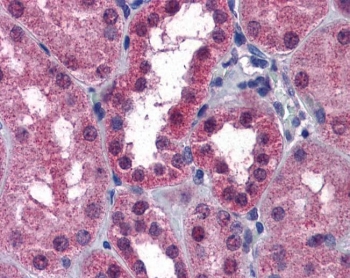 IHC staining of FFPE human kidney tissue with P2RX7 antibody at 3.75ug/ml. HIER: steamed with pH6 citrate buffer, AP-staining.