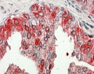 IHC staining of FFPE human prostate with ACPP antibody at 4ug/ml. HIER: steamed with pH6 citrate buffer, AP-staining.