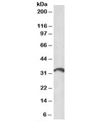 ICOS ligand Antibody Lymph Node WB. Western blot testing of human lymph node lysate with ICOS ligand antibody at 1ug/ml. Predicted/observed molecular weight: ~33 kDa.