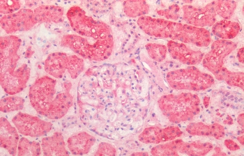 IHC staining of FFPE human kidney tissue with HSP60 antibody at 5ug/ml. Required HIER: steamed antigen retrieval with pH6 citrate buffer; AP-staining.