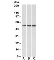 HMGCS1 Antibody Multi-Cell Line WB. Western blot analysis of A) HeLa, B) HepG2, and C) K562 cell lysates using HMGCS1 Antibody. A distinct immunoreactive band is detected at approximately 57 kDa in all three cell lines, consistent with the predicted molecular weight of HMGCS1 (3-Hydroxy-3-Methylglutaryl-CoA Synthase 1). HMGCS1 is a key cytosolic enzyme of the mevalonate pathway that catalyzes the synthesis of HMG-CoA, an essential precursor for cholesterol and isoprenoid biosynthesis. The consistent detection of a single band across multiple human cell lines supports specific recognition of endogenous HMGCS1 and demonstrates the utility of this antibody for western blot applications. Predicted molecular weight: ~57 kDa. Observed molecular weight: ~57 kDa.