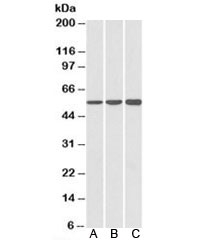 HMGCS1 Antibody Human Cell Line WB. Western blot analysis of A) HeLa, B) HepG2, and C) K562 cell lysates using HMGCS1 Antibody demonstrates a prominent immunoreactive band at approximately 57 kDa in each sample, consistent with the expected molecular weight of HMGCS1 (3-Hydroxy-3-Methylglutaryl-CoA Synthase 1). HMGCS1 is a key cytosolic enzyme of the mevalonate pathway that catalyzes the production of HMG-CoA, an essential precursor for cholesterol and isoprenoid biosynthesis. The consistent detection of HMGCS1 across multiple human cell lines supports specific recognition of endogenous protein and demonstrates the suitability of this antibody for western blot applications. Predicted molecular weight: ~57 kDa. Observed molecular weight: ~57 kDa.