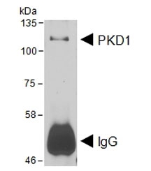 2ug of PKD1 antibody was used to immunoprecipitate PDK1 from transfected HEK293 cells which was then western blot tested with the same PKD1 antibody at 1ug/ml. Expected molecular weight ~102 kDa. Data courtesy of Dr Peter Storz, Mayo Clinic, USA.