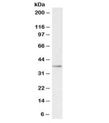 PTGR1 Antibody Human Kidney Western Blot. Western blot analysis of human kidney lysate using PTGR1 Antibody at 0.3 Âµg/ml demonstrates a distinct band at approximately 36-38 kDa, consistent with the predicted molecular weight of Prostaglandin Reductase 1 (PTGR1). PTGR1 is a NADP-dependent oxidoreductase involved in prostaglandin and leukotriene metabolism, helping regulate eicosanoid signaling pathways associated with inflammation, oxidative stress responses, and lipid mediator turnover. Detection of the expected molecular weight band in human kidney tissue supports expression of PTGR1 and the suitability of this antibody for western blot applications.