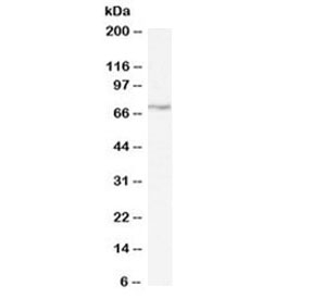 Western blot testing of rat pancreas lysate with LIMK2 antibody at 0.3ug/ml. Predicted molecular weight ~72 kDa (LIMK2a) and ~69 kDa (LIMK2b).