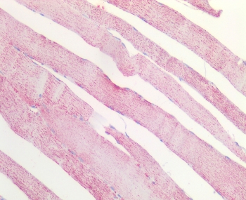 IHC staining of FFPE human skeletal muscle tissue with MDH2 antibody at 5ug/ml. Required HIER: steamed antigen retrieval with pH6 citrate buffer; AP-staining.
