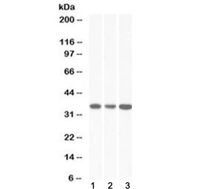 Western blot testing of human 1) HeLa, 2) HepG2 and 3) K562 lysate with MDH2 antibody at 0.03ug/ml. Predicted molecular weight ~35 kDa.