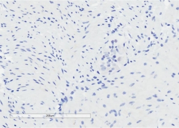 IHC testing of FFPE human colon tissue without GPR120 antibody (negative control). HIER: steam section in pH6 citrate buffer for 20 min.