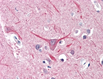 UBR2 Antibody Brain Immunohistochemistry. IHC testing of FFPE human brain (cortex) tissue with UBR2 antibody at 5ug/ml. HIER: steamed antigen retrieval with pH6 citrate buffer; AP-staining.