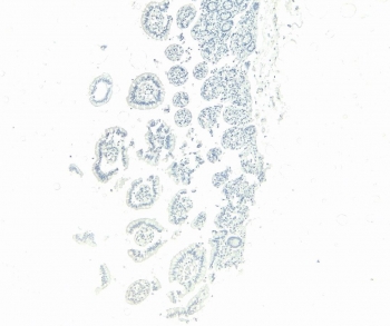 Negative control: IHC staining of FFPE human small intestine tissue without primary antibody. Required HIER: steamed antigen retrieval with pH6 citrate buffer; HRP-staining.