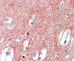 IHC staining of FFPE human cortex tissue with VGLUT1 antibody at 3.75ug/ml. Required HIER: steamed antigen retrieval with pH6 citrate buffer; AP-staining.