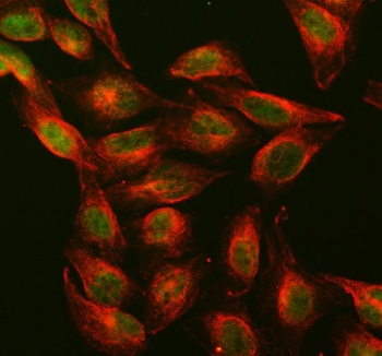 DNMT1 Antibody U-2 OS Cell IF. Immunofluorescence analysis of FFPE human U-2 OS cells using DNMT1 Antibody (green) shows predominant nuclear staining consistent with localization of DNA methyltransferase 1 during epigenetic maintenance. Alpha Tubulin mAb (red) highlights the cytoskeletal network, providing cellular context and contrast. The nuclear enrichment of signal supports DNMT1 function in DNA methylation and chromatin regulation. HIER: steam FFPE sections in pH 6 citrate buffer for 20 min.
