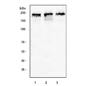 DNMT1 Antibody Multi-Cell Line WB. Western blot analysis of human 1) HeLa, 2) 293T, and 3) SH-SY5Y cell lysates using DNMT1 Antibody detects a band at approximately 180â200 kDa, consistent with the predicted molecular weight of DNMT1 / DNA methyltransferase 1. The strong, high-molecular-weight signal across all three cell lines supports detection of this nuclear maintenance methyltransferase, aligning with its role in preserving DNA methylation patterns during cell proliferation.