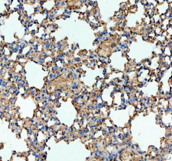 IHC staining of FFPE mouse lung tissue with Ace antibody. HIER: boil tissue sections in pH8 EDTA for 20 min and allow to cool before testing.