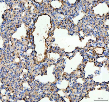 IHC staining of FFPE rat lung tissue with Ace antibody. HIER: boil tissue sections in pH8 EDTA for 20 min and allow to cool before testing.