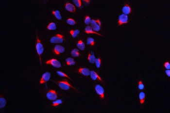 IF/ICC staining of FFPE human U-2 OS cells with CARS antibody (red) at 2ug/ml and DAPI nuclear stain (blue). HIER: steam section in pH6 citrate buffer for 20 min.