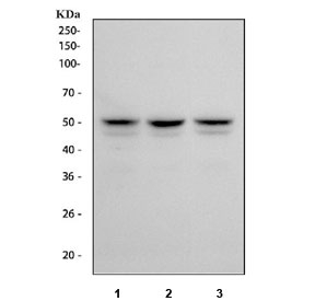 FOXA1 Antibody Multi-Cell Line Western Blot. Western blot analysis of human MCF7 (lane 1), HepG2 (lane 2), and RT4 (lane 3) cell lysates using FOXA1 Antibody demonstrates distinct bands at approximately 49 kDa, consistent with the predicted molecular weight of FOXA1. FOXA1 is a forkhead family transcription factor and pioneer regulator that facilitates chromatin accessibility and controls developmental gene expression programs involved in organogenesis, epithelial differentiation, and tissue-specific cellular identity. Detection of the expected molecular weight band across multiple epithelial-derived cell lines supports expression of FOXA1 and its role as a developmental transcription factor that coordinates lineage-specific transcriptional networks and differentiated cellular phenotypes.