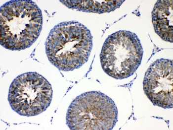 IHC testing of FFPE rat testis tissue with AGRP antibody at 1ug/ml. Required HIER: steam section in pH6 citrate buffer for 20 min and allow to cool prior to testing.