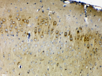 ERBB4 Antibody Mouse Brain IHC. Immunohistochemistry testing of FFPE mouse brain tissue with ERBB4 antibody at 1ug/ml. Required HIER: steam section in pH6 citrate buffer for 20 min and allow to cool prior to testing.