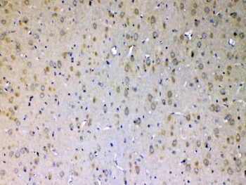 ERBB4 Antibody Rat Brain IHC. Immunohistochemistry testing of FFPE rat brain tissue with ERBB4 antibody at 1ug/ml. Required HIER: steam section in pH6 citrate buffer for 20 min and allow to cool prior to testing.