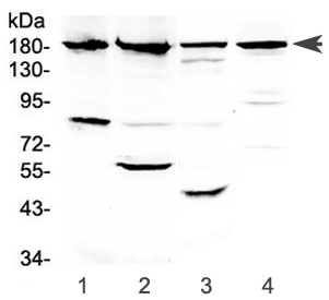 ERBB4 Antibody Human Mouse Rat WB. Western blot testing of 1) human PANC-1, 2) human placenta, 3) rat kidney and 4) mouse kidney lysate with ERBB4 antibody at 0.5ug/ml. Predicted molecular weight: 147-180 kDa (precursor), 120, 80 kDa (cleaved forms).