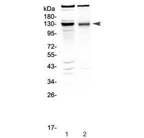 Western blot testing of 1) rat brain and 2) mouse brain tissue lysate with BMPR2 antibody at 0.5ug/ml. A prominent band is detected at approximately 130 kDa, migrating above the predicted 115 kDa size and consistent with the fully glycosylated mature BMPR2 receptor. A weaker band above 200 kDa is also observed and likely represents dimeric or higher order BMPR2 complexes that are not completely dissociated during electrophoresis.