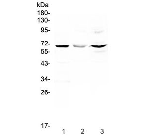 CD5 Antibody for WB. Western blot analysis of CD5 antibody in rat liver, mouse HEPA1-6, and human HeLa lysates using a T cell signaling regulator antibody at 0.5 ug/ml. Lane 1: rat liver lysate, Lane 2: mouse HEPA1-6 lysate, Lane 3: human HeLa lysate. A band is detected at approximately 55-67 kDa, consistent with the predicted molecular weight of CD5, with variation reflecting known glycosylation of this membrane receptor. Signal is strongest in human HeLa cells, with weaker detection in non-lymphoid samples, aligning with the known lymphocyte-associated expression profile of CD5.