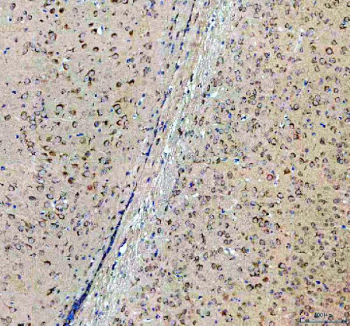 IHC staining of FFPE mouse brain tissue with Sacsin antibody, HRP-labeled secondary and DAB substrate. HIER: boil tissue sections in pH8 EDTA for 20 min and allow to cool before testing.